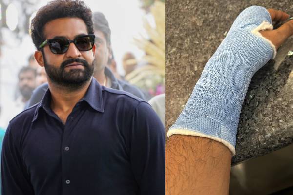 NTR team clarity regarding his injury