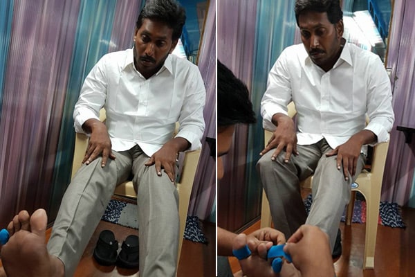 Blisters on feet, will Jagan take a break for Padayatra