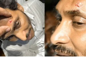 Stone Attack Incident: Failed to Evoke Sympathy for YSRCP?